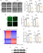 MMP1 Antibody in Western Blot (WB)