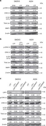 MMP1 Antibody in Western Blot (WB)