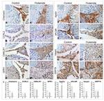 GRP78 Antibody in Immunohistochemistry (IHC)