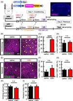 mCherry Antibody in Immunohistochemistry (IHC)