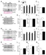 DNM1L Antibody in Western Blot (WB)