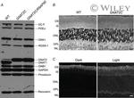 PDE6A Antibody in Western Blot (WB)