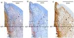 CD20 Antibody in Immunohistochemistry (IHC)