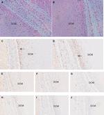 CD8 Antibody in Immunohistochemistry (IHC)