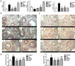 Caspase 3 Antibody in Immunohistochemistry (Paraffin) (IHC (P))