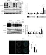 O-linked N-acetylglucosamine (O-GlcNAc) Antibody in Western Blot (WB)