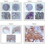 EphB4 Antibody in Immunohistochemistry (IHC)