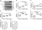 HIF1A Antibody in Western Blot (WB)