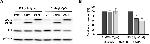 ZC3HAV1 Antibody in Western Blot (WB)