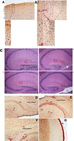 IBA1 Antibody in Immunohistochemistry (IHC)