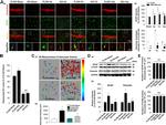 Aromatase Antibody in Immunocytochemistry, Immunohistochemistry (ICC/IF, IHC)