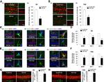 Aromatase Antibody in Immunocytochemistry (ICC/IF)