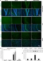 Ubiquilin 2 Antibody in Immunohistochemistry (IHC)