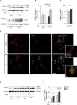 LC3B Antibody in Western Blot, Immunocytochemistry (WB, ICC/IF)