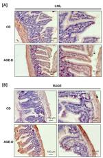 RAGE Antibody in Immunohistochemistry (IHC)