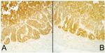 SDHB Antibody in Immunohistochemistry (IHC)