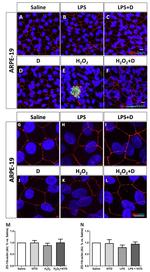 ZO-1 Antibody in Immunocytochemistry (ICC/IF)