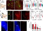 mCherry Antibody in Immunocytochemistry (ICC/IF)