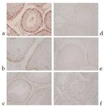 MAGE1 Antibody in Immunohistochemistry (IHC)