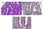 MAGE1 Antibody in Immunohistochemistry (IHC)