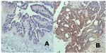 Dicer Antibody in Immunohistochemistry (IHC)