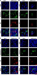 Cytokeratin 5 Antibody in Immunocytochemistry (ICC/IF)