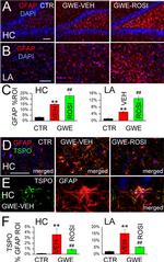 TSPO Antibody in Immunohistochemistry (IHC)