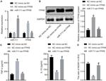 ITPKB Antibody in Western Blot (WB)