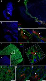 MBP Antibody in Immunohistochemistry (IHC)