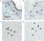 MDM2 Antibody in Immunohistochemistry (IHC)