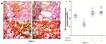 Bcl-2 Antibody in Immunohistochemistry (IHC)