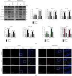 IBA1 Antibody in Immunohistochemistry (IHC)