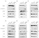 PARP1 Antibody in Western Blot (WB)