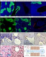 Podoplanin Antibody in Immunohistochemistry (Paraffin) (IHC (P))