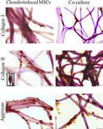 Aggrecan Antibody in Immunocytochemistry (ICC/IF)