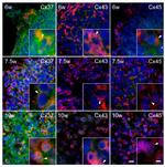 PGP9.5 Antibody in Immunohistochemistry (IHC)