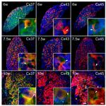 PGP9.5 Antibody in Immunohistochemistry (IHC)