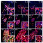 PGP9.5 Antibody in Immunohistochemistry (IHC)