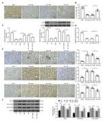 TGF beta-1 Antibody in Western Blot, Immunohistochemistry (WB, IHC)