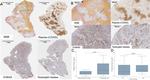 S100A9 Antibody in Immunohistochemistry (IHC)