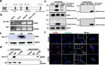 Calnexin Antibody in Immunocytochemistry (ICC/IF)