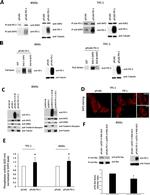 Pan Ras Antibody in Western Blot, Immunoprecipitation (WB, IP)