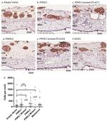 CD44 Antibody in Immunohistochemistry (IHC)