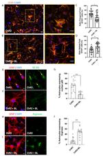 GFAP Antibody in Immunocytochemistry (ICC/IF)