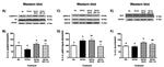 Bcl-2 Antibody in Western Blot (WB)