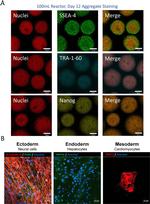 Cardiac Troponin T Antibody in Immunocytochemistry (ICC/IF)