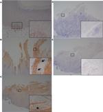 Complement Factor B Antibody in Immunohistochemistry (Paraffin) (IHC (P))