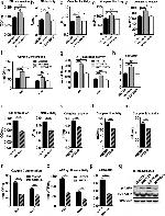 Phospho-AMPK alpha-1,2 (Thr183, Thr172) Antibody in Western Blot (WB)