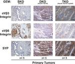 Synaptophysin Antibody in Immunohistochemistry (IHC)