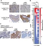 Synaptophysin Antibody in Immunohistochemistry (IHC)